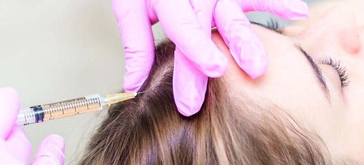 Мезотерапия лица и волосистой части головы 