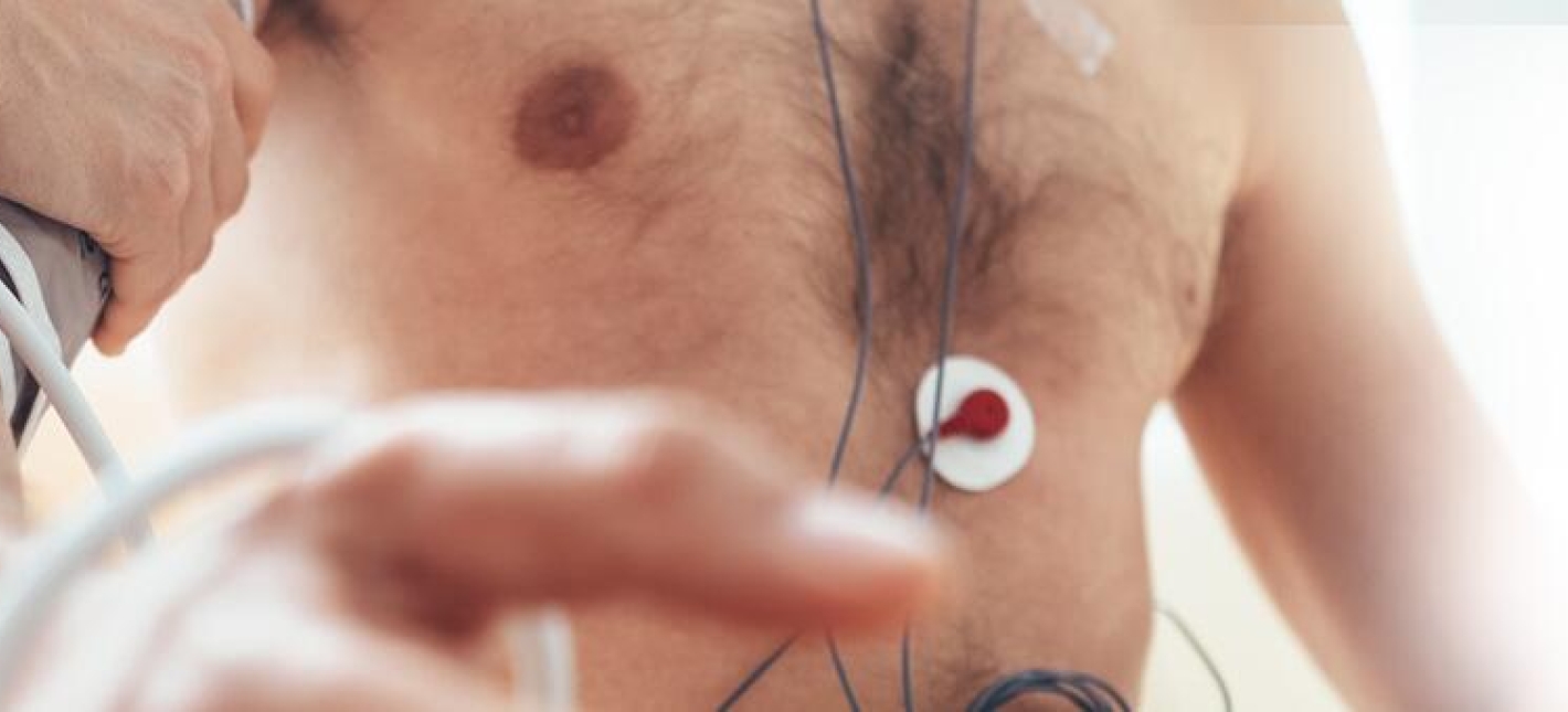 Электрокардиография ЭКГ