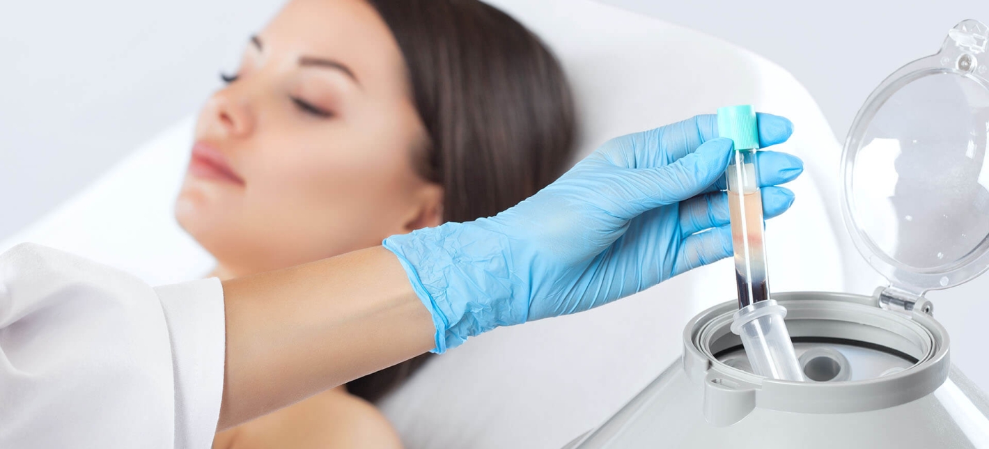 Плазмотерапия (без учета стоимости пробирки и забора) 