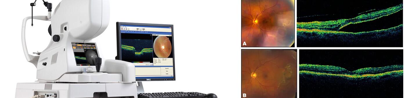 Офтальмологический комплекс для взрослых «ПРЕМИУМ» глаукома