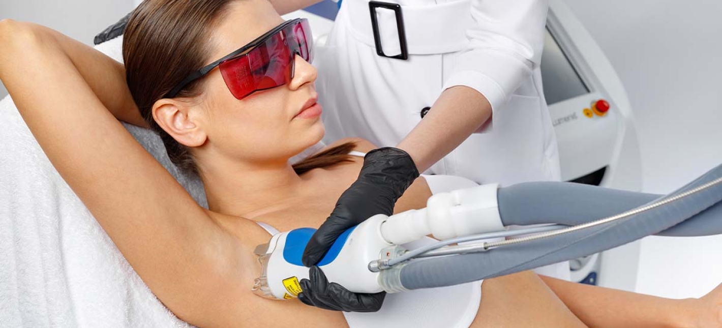 Лазерная эпиляция