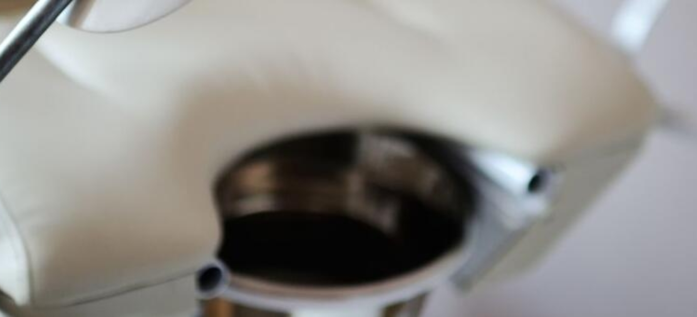 Проба Шуварского (посткоитальный тест)